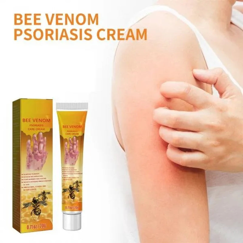 1* Bee-Venom Psoriasis Health Care Cream Treatment Soothing and Moisturizing