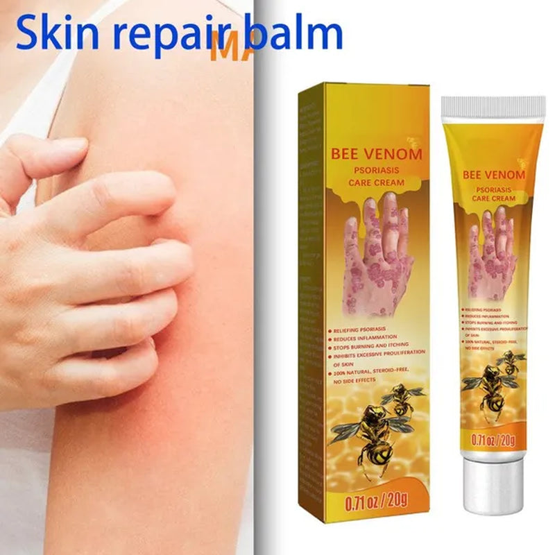  Bee- Venom- Psoriasis- Health -Care -Cream.jpg